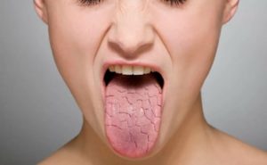 Болит горло и язык