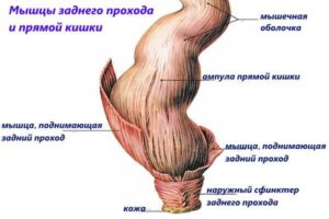 Спазм анального сфинктера