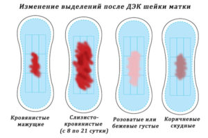 Кровянистые выделения после швов на шейке матки при беременности