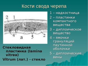 Периостит наружной кортикальной пластинки костей свода черепа