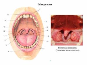 Увеличилась язычная миндалина и белая шишечка на ней