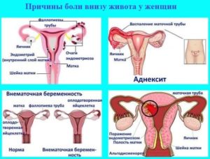 Подняла тяжёлое во время менструации болит живот в низу