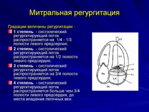 Результат УЗИ сердца: митральная регургитация 1 степени, трикуспидальная регургитация 1 степени