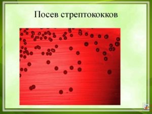 В посеве streptococcus pyogenes