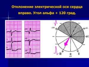 Отклонение ЭОС вправо