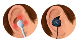 Заложенное ухо после наушников