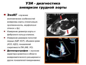 Дилатация восходящей аорты у ребенка