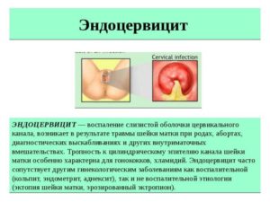 Половая жизнь при лечении цервицита