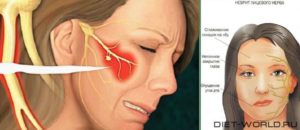 Болит голова и дергаются мышцы лица