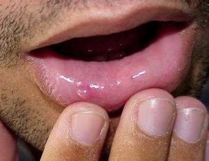 Видна слизистая нижней губы