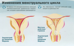 Плохое самочувствие, после менструального цикла