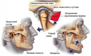 Боль в челюсти и шейный остеохондроз
