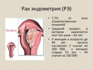 Онкомаркер при раке эндометрия матки