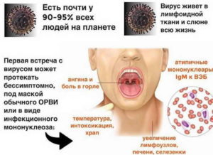 Вирус эпштейна барра и прививка от кори