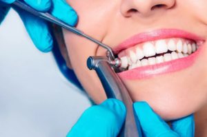 Восстановление десны после удаления зубного камня