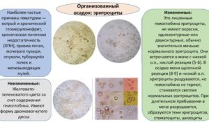 Эритроциты в моче от аллергии