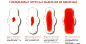 Задержка месячных после клотримазола и тинидазола