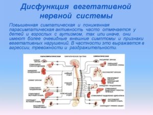 Дисфункция вегетативной нервной системы