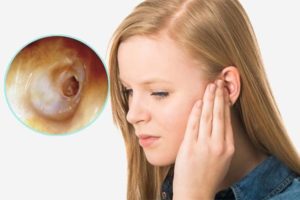 Уменьшается слуховое отверстие в ухе