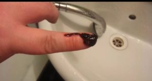 Обильные месячные первые 2 дня