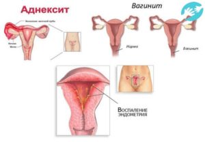 Подняла тяжёлое во время менструации болит живот в низу