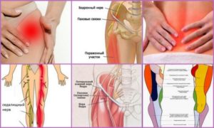 Болит правая нога от бедра до колена
