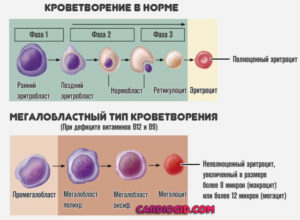 Снижение лейкоцитов до 2,68