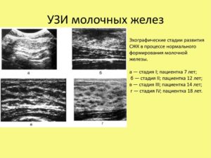 Профилактика по узи молочных желез