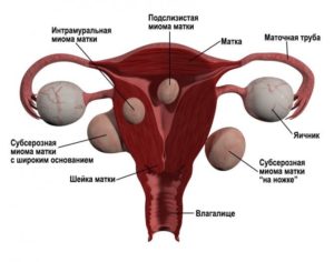 Вздулась область матки