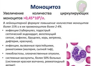 Повышены моноциты консультация