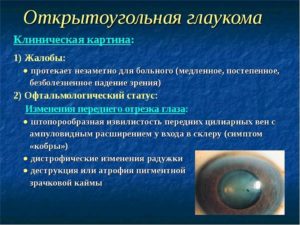 Нозальные при открытоугольной глаукоме
