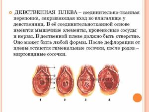 Как может растянутся девственная плева?