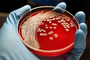 В посеве streptococcus pyogenes