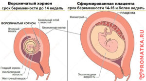 Замершая беременность плацентарный полип