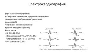 Зачем направляют на ЭКГ после рентгена грудного отдела