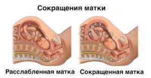 Тонус матки до начала месячных