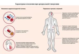 Высокое давление и боли в сердце