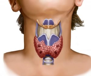 Запор и щитовидка - связь
