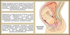 Боль при беременности в мочевом пузыре