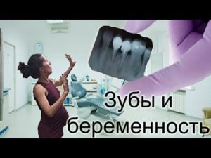 Рентген зуба и беременность