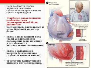 Дискомфорт в области сердца при смене положения тела