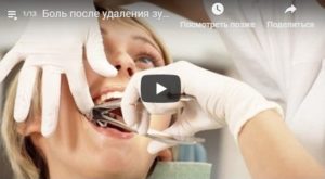 Онемение лица после удаления зуба
