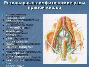 Параректальные лимфоузлы