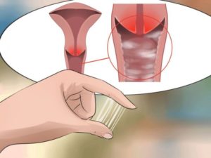 Кровянистые выделения после клотримазола