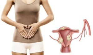 Маленькая матка