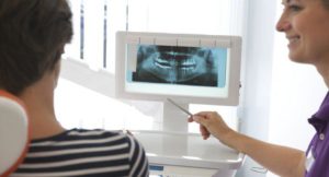 Рентген зуба и беременность