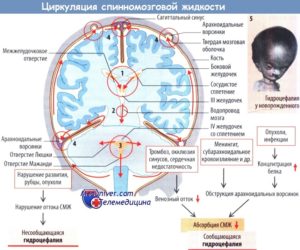 Скопление жидкости по конвексу