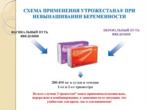 Приём Утрожестана при планировании беременности