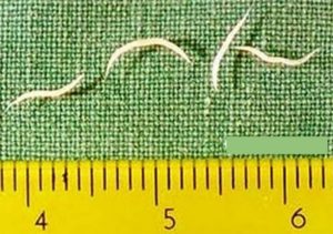 Белые тонкие черви в письке. Что это и как лечить?