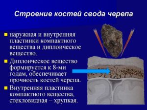 Периостит наружной кортикальной пластинки костей свода черепа